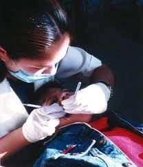 Tratamiento restaurador atraumático nueva alternativa bucodental: SSA