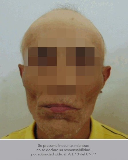 Dan prisión preventiva a señalado de agredir a su pareja sentimental