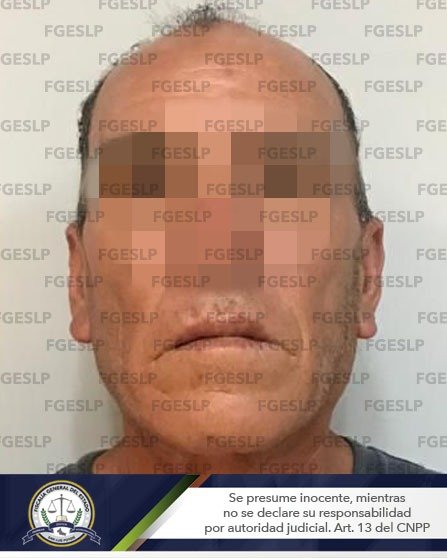 En Rayón Fiscalía detiene a hombre por probable tentativa de feminicidio