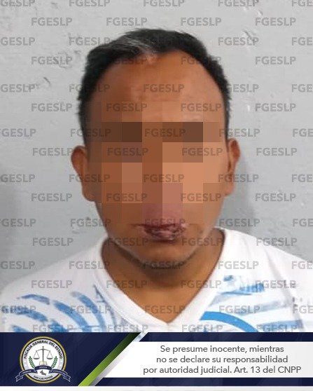 Detienen a hombre por ataque peligroso y homicidio calificado