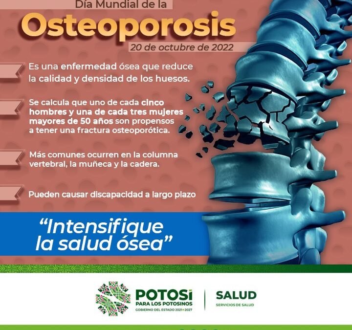 CELEBRACIÓN MUNDIAL PARA CONCIENTIZAR SOBRE LA OSTEOPOROSIS, CADA 20 DE OCTUBRE